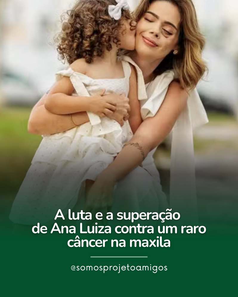 Aos 29 anos, a cirurgiã-dentista Ana Luiza Prestes, de São Bernardo do Campo (SP), teve sua vida transformada ao ser diagnosticada com carcinoma adenoide cístico, um raro câncer de cabeça e pescoço. Os primeiros sintomas surgiram em outubro de 2023, com dormência no céu da boca e dores ao consumir bebidas geladas. Com o avanço do tumor, ela passou a ter dificuldade para respirar, levando-a a procurar um otorrino. Após exames, descobriu um tumor de 5 cm na maxila, recebendo a notícia de seu câncer de forma dolorosa.