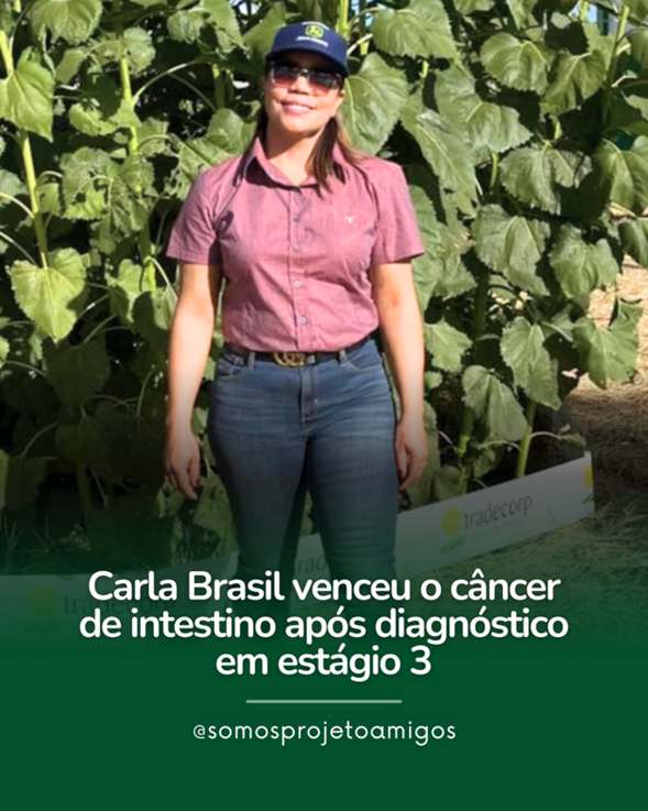 O câncer de intestino é um tipo de tumor agressivo e silencioso, com sintomas que geralmente só aparecem em estágios mais avançados. A estimativa é de que os casos aumentem de 50 mil por ano para mais de 70 mil até 2040 no Brasil. Em meio a esse cenário, a história de superação de Carla Brasil Melo, de 46 anos, moradora de Luziânia (GO), mostra que é possível vencer a doença com atenção aos sinais do corpo e um atendimento rápido.