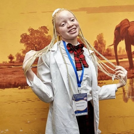 Mwape Chimpampa e seu protetor solar orgânico para albinos zambianos.