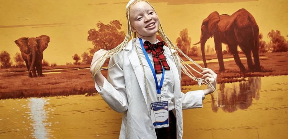 Mwape Chimpampa e seu protetor solar orgânico para albinos zambianos.