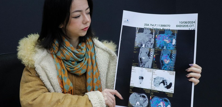 A jornada de Bruna: três anos buscando o diagnóstico certo para seu câncer